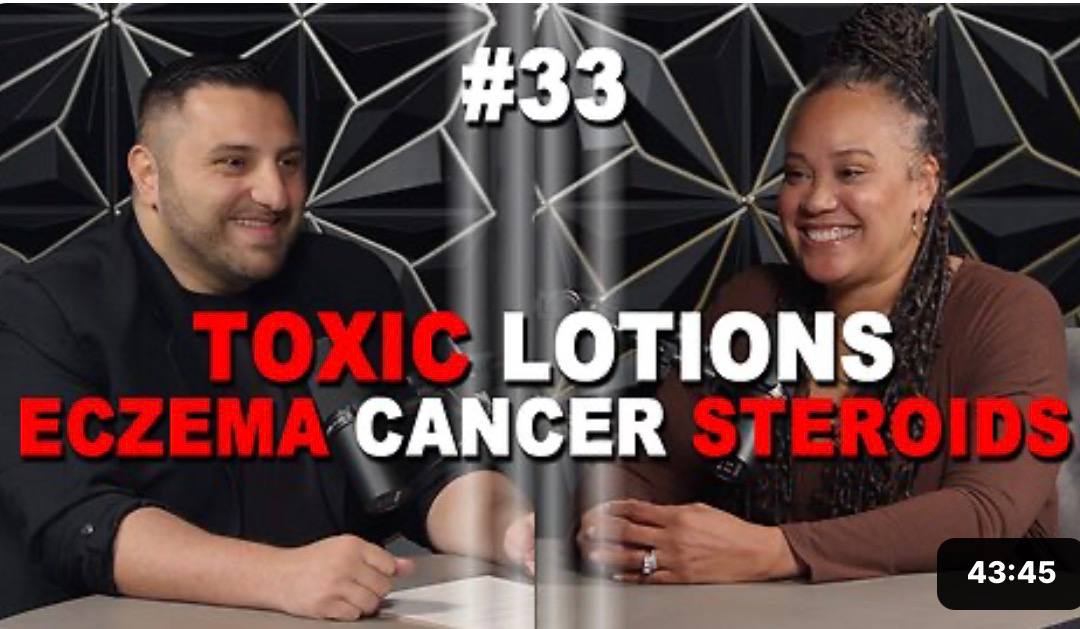 Ep 33 Toxic Lotions 9MrRrK3w